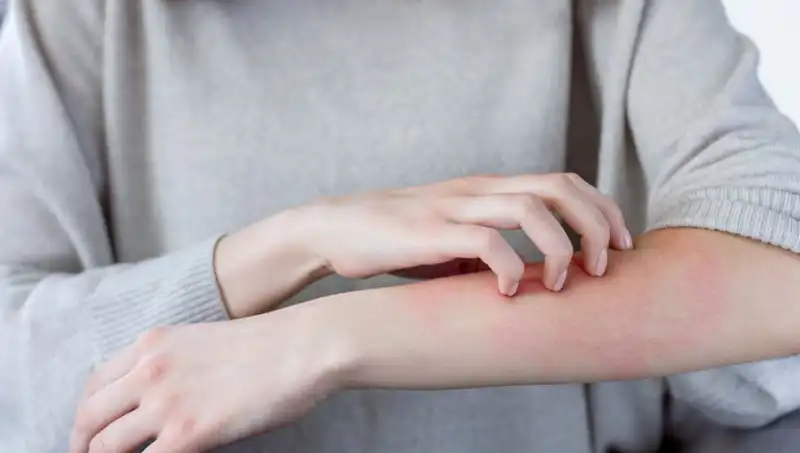 Cilt Kanserine Dikkat: Dermatologun Uyardığı İki Belirtiler!