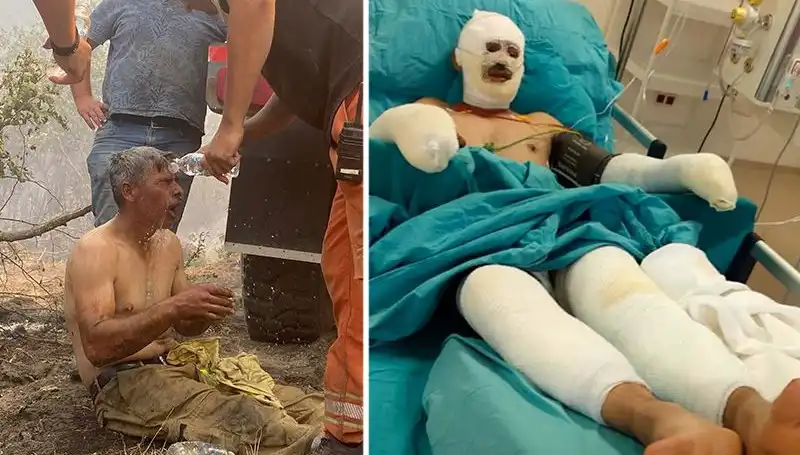 Orman Küllerinde Hayata Dönmeye Çalışan İşçinin Dramı