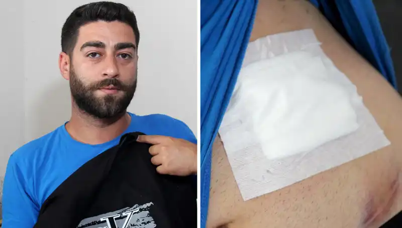 Karnındaki Ağrı Nedenini Öğrenmek için Röntgene Girdi, Şok Edici Sonuçla Karşılaştı