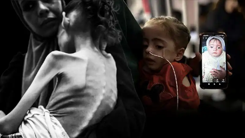 Küçük Meryem’in Açlıkla Mücadelesi: 25 Kilodan 10 Kiloya Düşen Bir Çocuğun Hikayesi