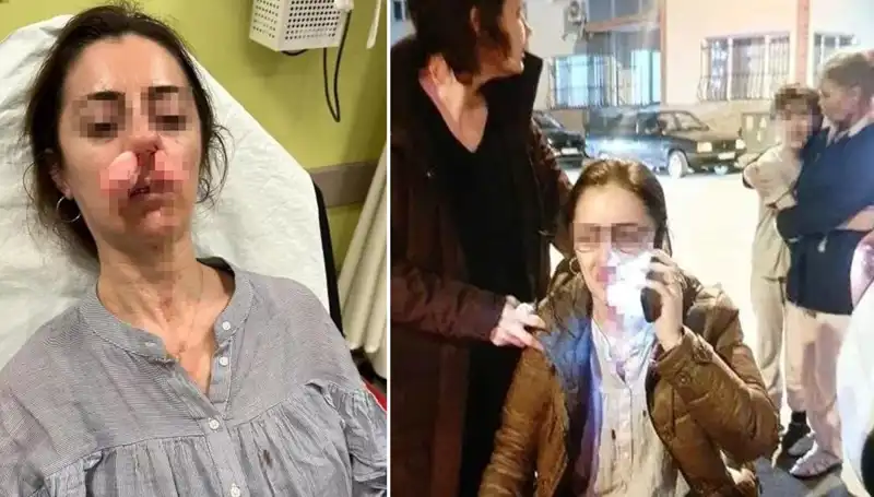 Eşinin Sevgilisi Sandığı Kişiye Otomobil Kapısıyla Saldırdı!